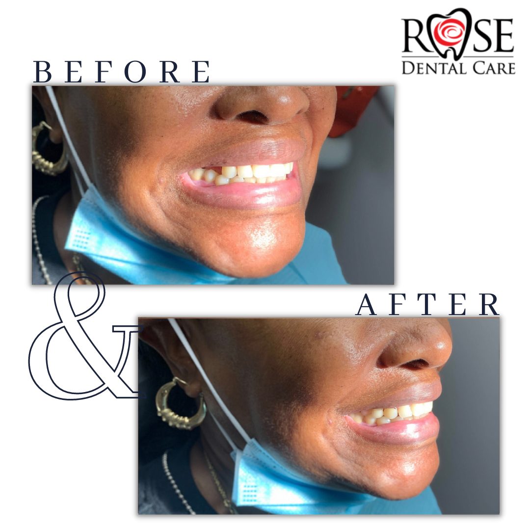 Rose Dental Care of Tyler