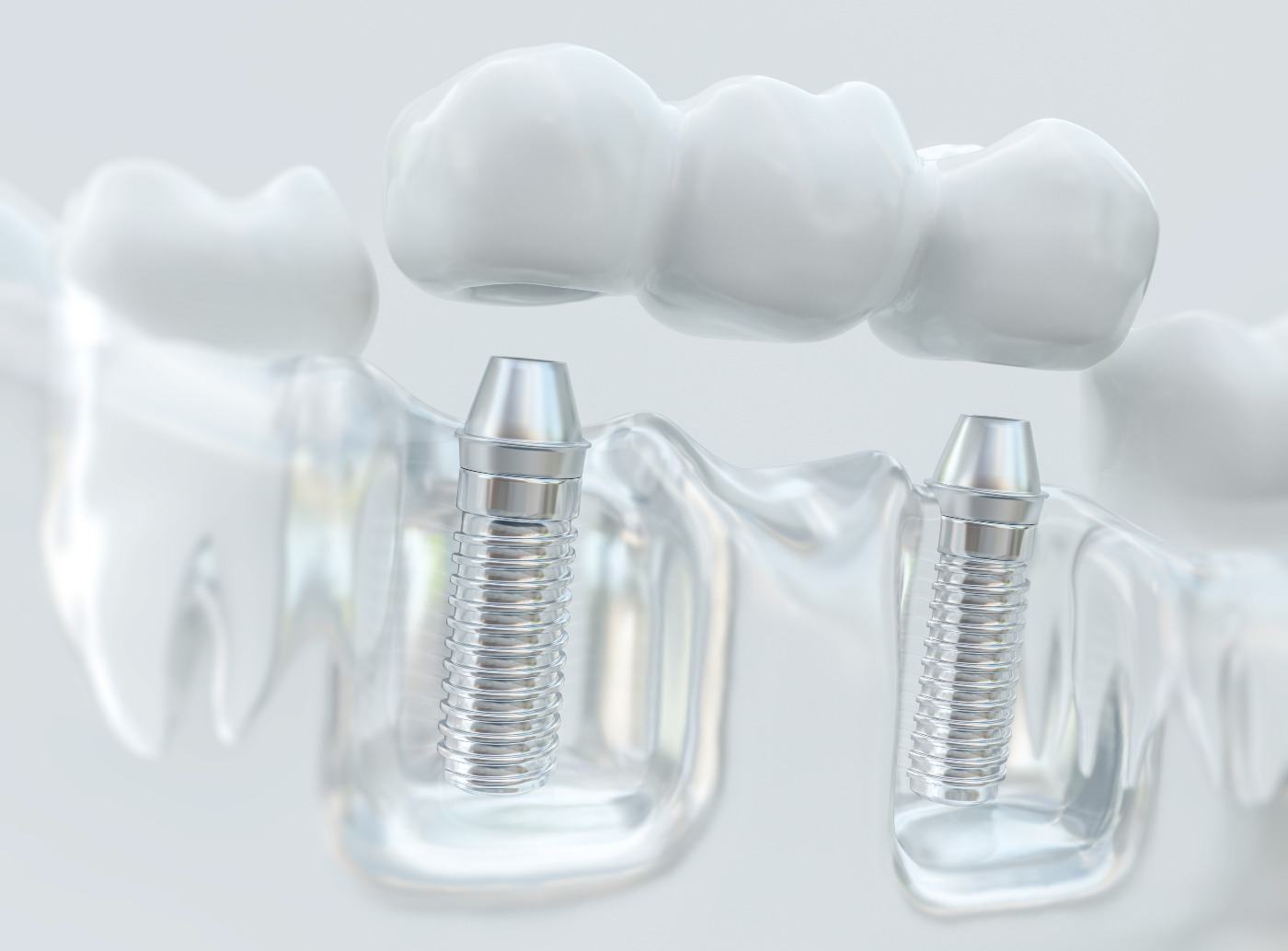 Rose Dental Care of Tyler