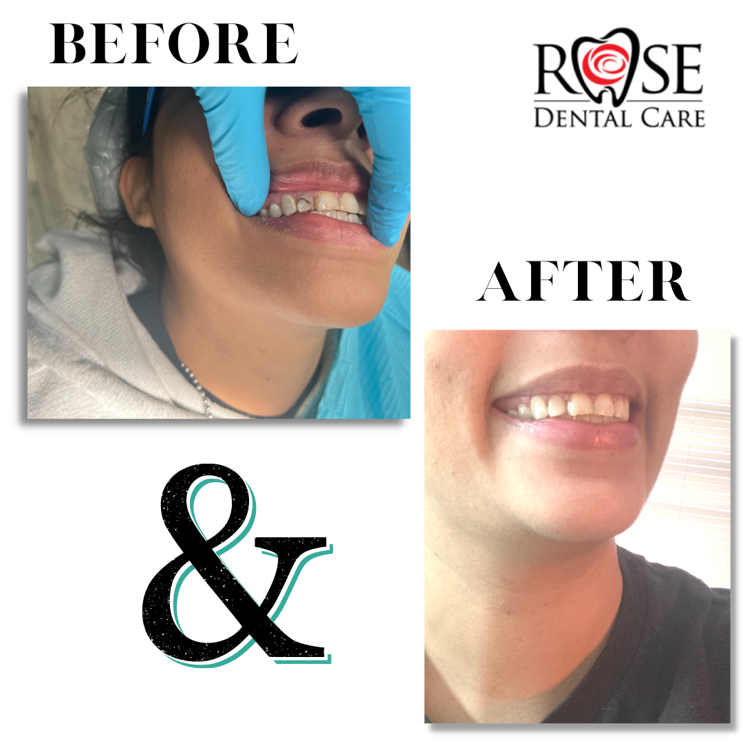 Dentist Tyler TX Rose Dental Care