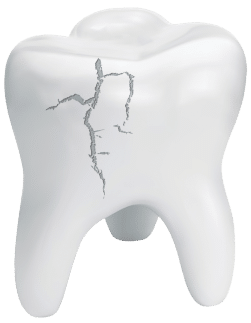 Emergency Dentist in Tyler, TX - Rose Dental Care