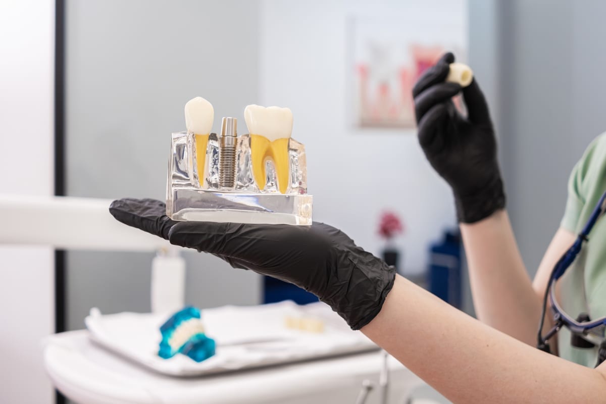 Dental Crowns in Tyler