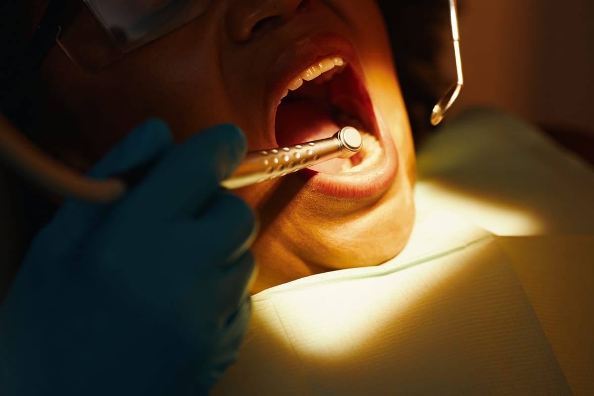 Root Canal Treatment in Tyler